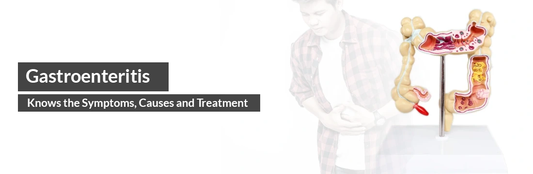 Gastroenteritis: Knows the Symptoms, Causes and Treatment